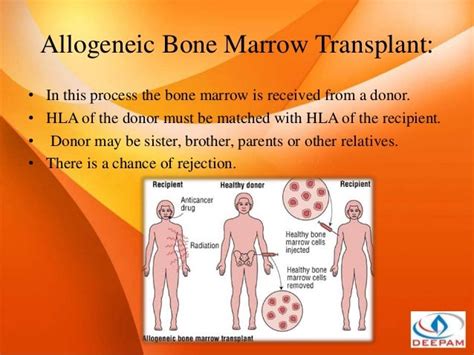 Bone Marrow Transplant Surgery In India