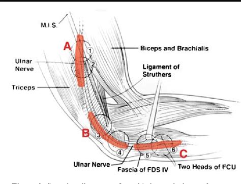 Ulnar Nerve Entrapment At The Elbow Cubital Tunnel