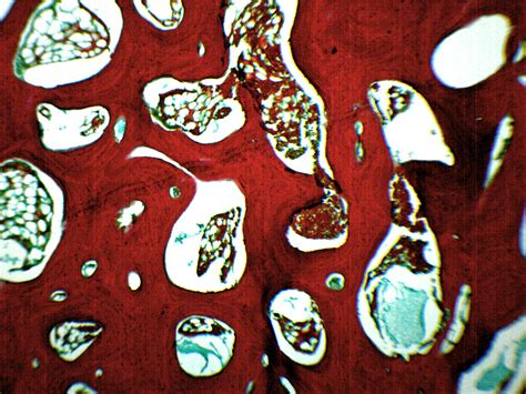 Spongy Bone Section Mammal Prepared Microscope Slide 75x25mm