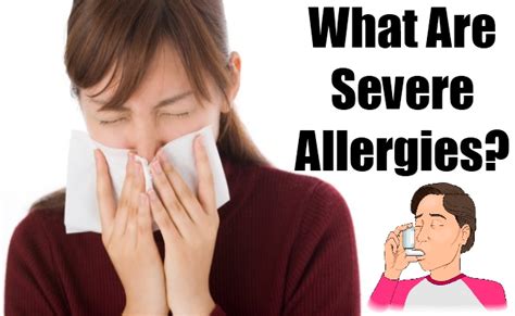 What Are Severe Allergies Natural Home Remedies And Supplements