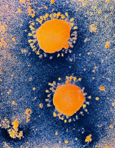 The Coronavirus Is New But Your Immune System Might Still Recognize It