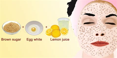 How To Whiten Skin With Lemon