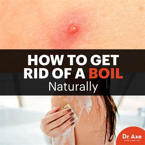 How To Ease Boil Pain Cousinyou