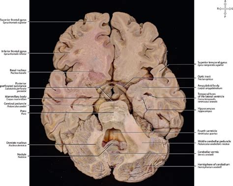 Axial Brain Anatomy