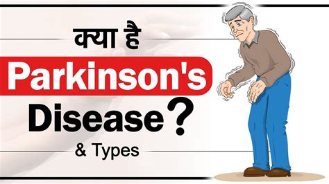 क्या है Parkinsons Disease Different Stages Of Parkinsons Disease Types Sriaas Youtube