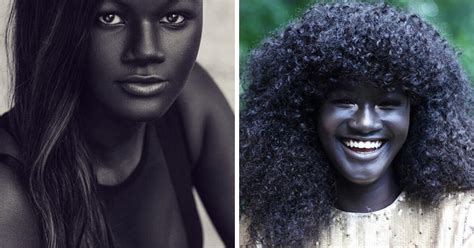Teen Bullied For Her Amazingly Dark Skin Becomes A Model And Conquers