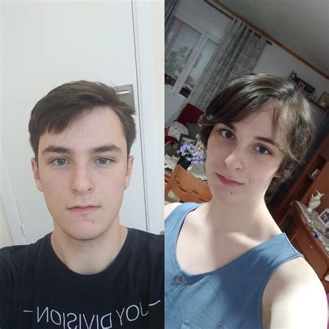 Mtf 20 Left 5 Months Before Hrt Right 5 Months On Hrt R