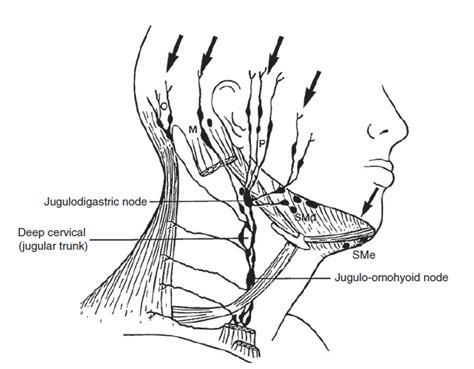The Lymph Nodes In The Face And Neck Region And The Areas Of Drainage