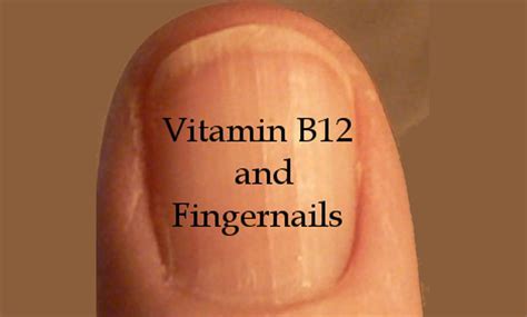 Vitamin B12 And Fingernails Your Roadmap To Health