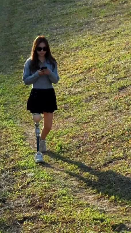 An Amputee Girl With Prosthetic Leg Is Walking Alo Tumbex