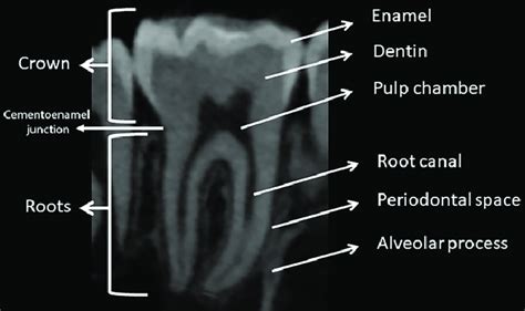 Tooth Anatomy Sagittal Conebeam Ct Image Demonstrates The Two Main