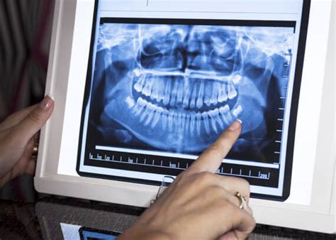 Dental X Rays Safe For All Patients Definitive Dental