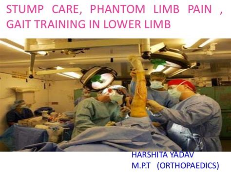 Amputationstump Care Phantom Limb Pain And Gait Training In Lower L