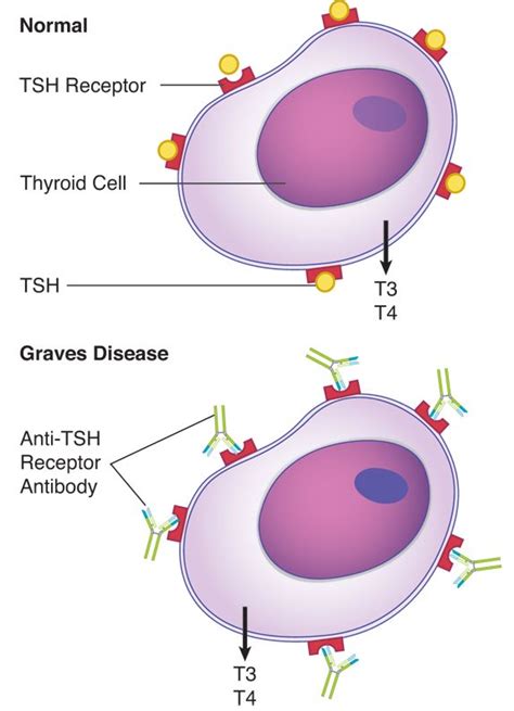 Antibodies To The Tsh Receptor In Graves Disease Graves Disease Tsh