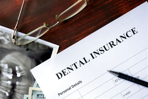 Enroll in our dental insurance that covers dentures alternative. Does Insurance Cover Dental Implants? | Dentist in Worcester MA