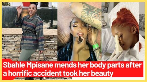 Sbahle Mpisane Mends Her Body Parts After A Horrific Accident Took Her