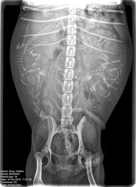 X Ray Of Pregnant Womans Abdomen For Fine Positioning Podcast Diaporama
