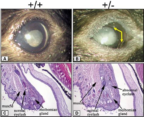 position of normal eyelashes in foxc2 wildtype þ þ mouse a download scientific
