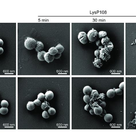 Sem Micrographs Of Mrsa Strains Xn108 And Sccmec V After Incubation