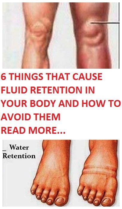 6 Things That Cause Fluid Retention In Your Body And How To Avoid Them