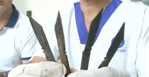 Man Of Steel Doctors Remove 40 Knives From Mans Stomach Huffpost