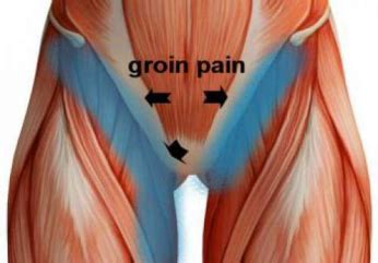 Diagram Of Male Groin Area Defining Of Groin Measurement Area