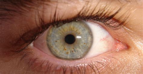 Detecting Schizophrenia The Eyes Have It Cnet