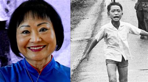 After Taking Years To Overcome Her Burn Injury Kim Phuc PhanThi Known As Napalm Girl Is