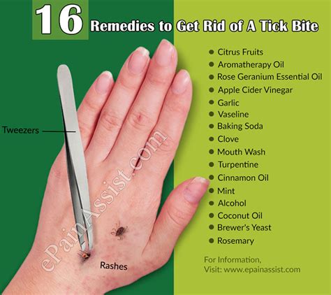 How To Treat Tick Bites