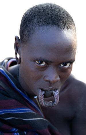 Africa Tribal Lip Plate Removed Ethiopia Mursi Tribe In Mursi