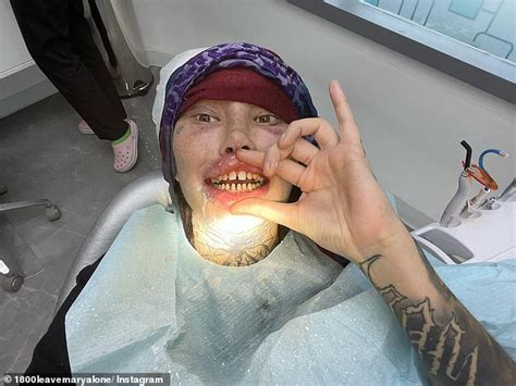 Surgery Addicted Star Mary Magdalene Wants Bigger Implants To Become A Stick With Balloons