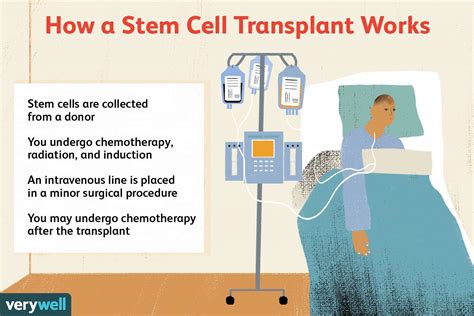 Stem Cell Transplant For Multiple Myeloma