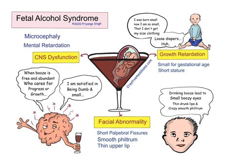 Fetal Alcohol Syndrome FAS Creative Med Doses