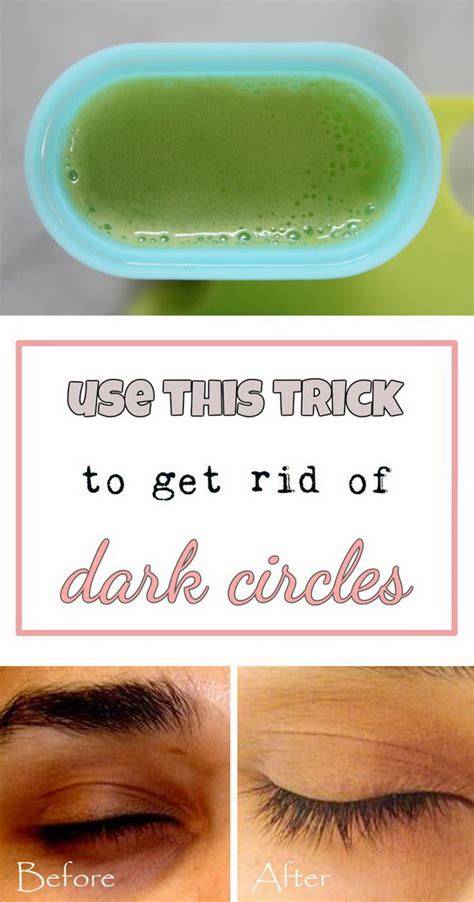 15 Ways To Get Rid Of Dark Circles Under Your Eyes Hative