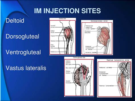 ppt intramuscular injection powerpoint presentation free download id 1450031