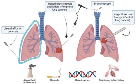 causes of lung cancer include smoking second hand smoke exposure download scientific diagram