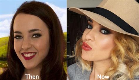 Stephanie Davis Plastic Surgery Before And After Photos