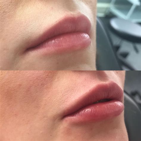 Hollie Houston Lip Fillers Permanent Make Up Lips Created By Hollie