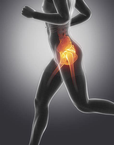 Hip Osteoarthritis Hip Joint Osteoarthritis Pain Form The Hip Experts