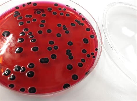 Salmonella Enterica On Xld Agar Microbiology