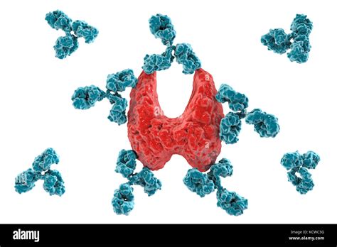 Autoimmune Thyroiditis Hashimotos Disease Conceptual Illustration