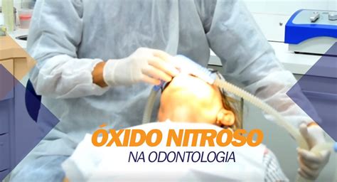 Xido Nitroso Na Odontologia Iom Instituto Odontol Gico