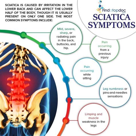 Sciatica Symptoms Causes Treatment And Diagnosis Findatopdoc