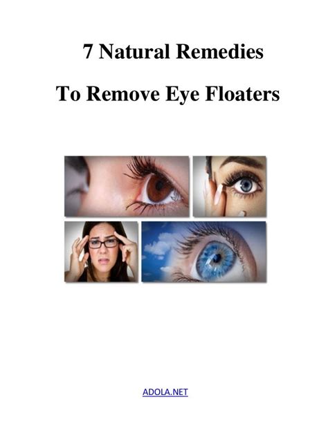 7 Natural Remedies To Remove Eye Floaters