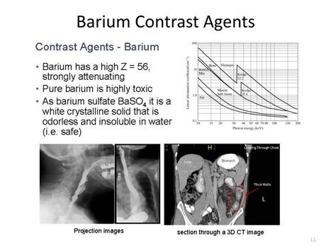 Ppt Ct Contrast Agents Module 3 Powerpoint Presentation Free