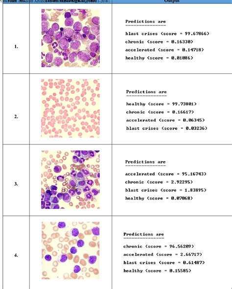Phase Classification Of Chronic Myeloid Leukemia Using Convolution Vrogue