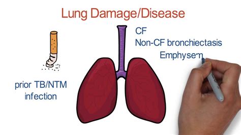 Nontuberculous Mycobacterial Lung Disease Today And Tomorrow Youtube