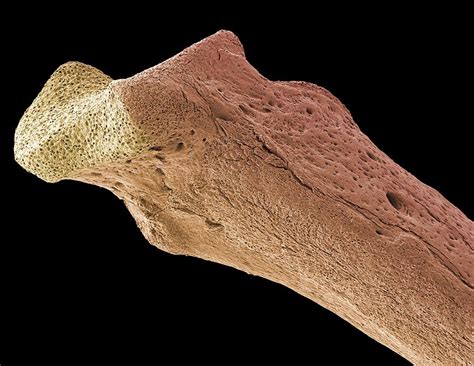 Osteoporotic Bone Sem Photograph By Steve Gschmeissner Pixels