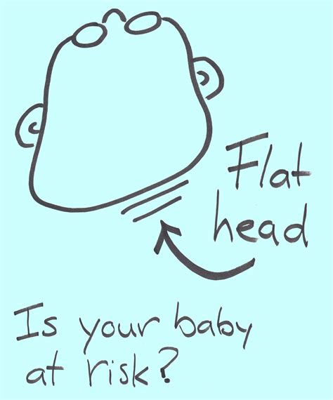 Is Your Baby At Risk Of A Flat Head Sure Start Health