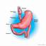 Bariatric Surgery Is A Critical Tool For Type 2 Diabetes Treatment 